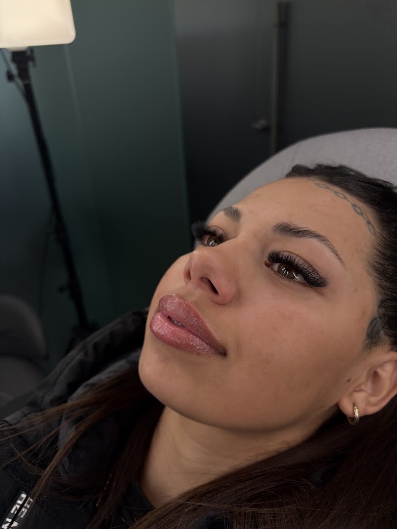 Resultado de diseño de labios