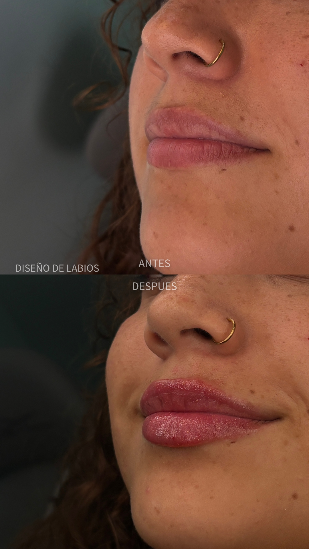 Caso de diseño de labios 1